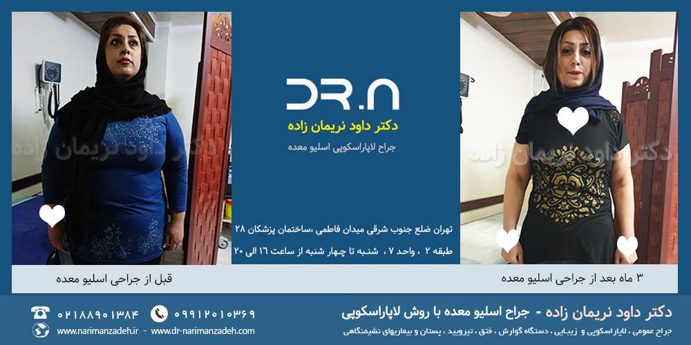 بهترین جراح اسلیو معده